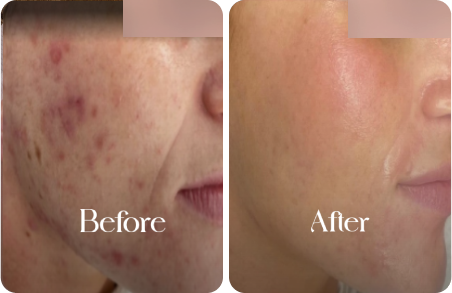 sn-before-after-img10