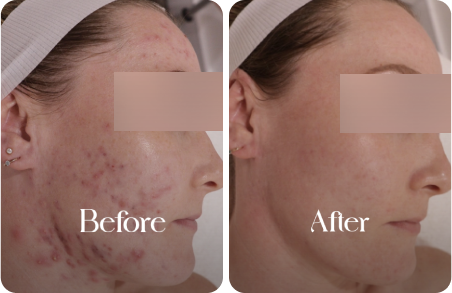 sn-before-after-img11