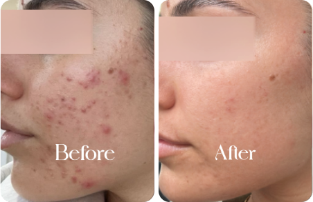 sn-before-after-img12