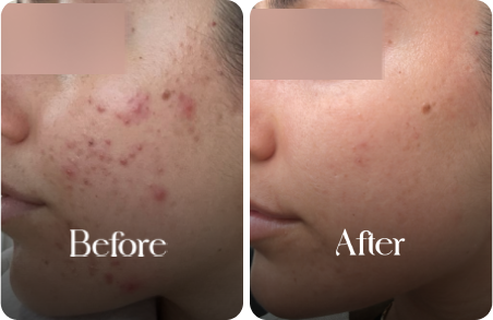 sn-before-after-img4