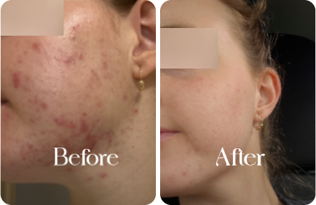 sn-before-after-img13